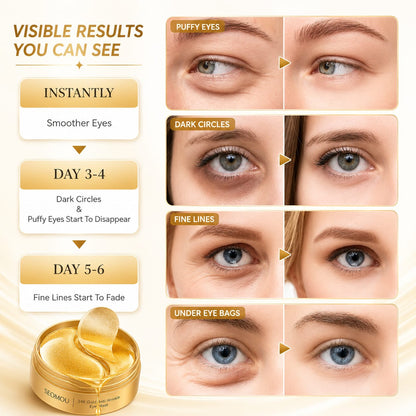 GoldLift™ 24K Gold Collagen Eye Patches